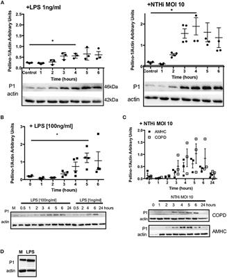 Pellino-1 Regulates Immune Responses to Haemophilus influenzae in Models of Inflammatory Lung Disease